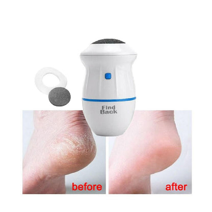 Removedor De Callos Quita Callos RF